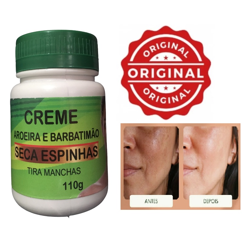 Clareador De Manchas Facial Melasma Espinhas Shopee Brasil