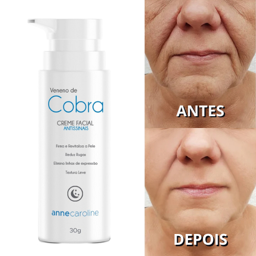 Creme Facial Hidratante Veneno De Cobra Nano Cido Hialur Nico