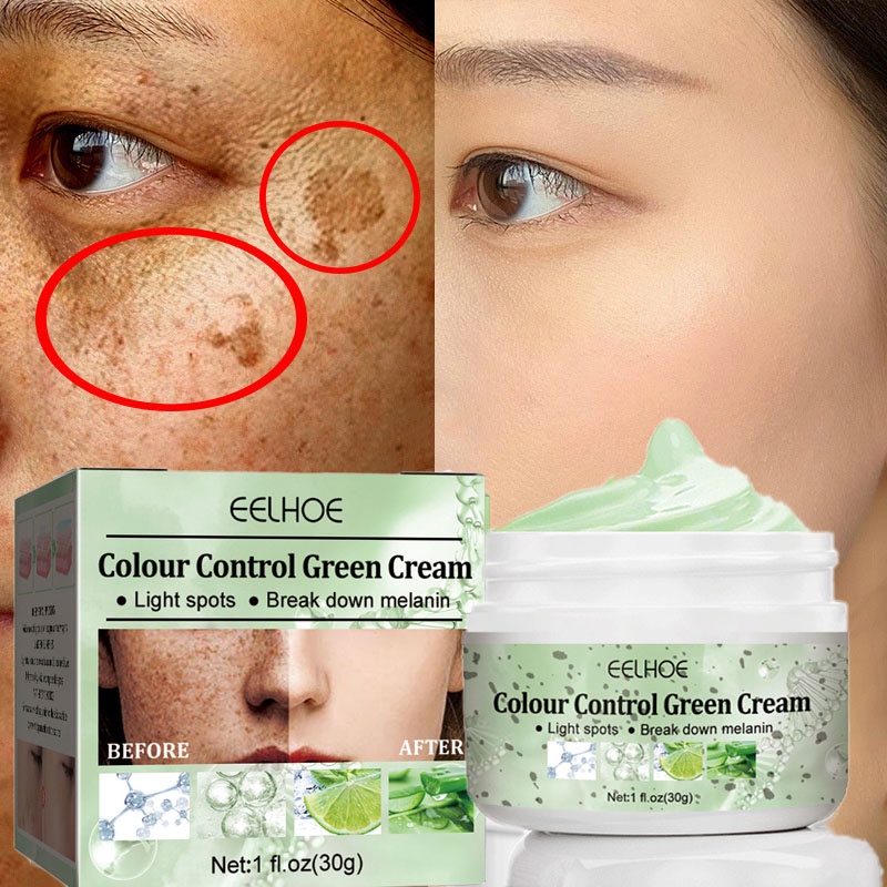 Creme Branqueador Eficaz Removedor De Sardas Melasma Escuro Iluminar