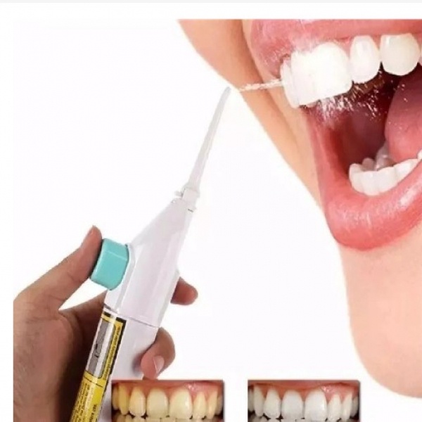 Jato De Gua Port Til Picareta Dental Limpeza Dentes Floss Oral Hidro