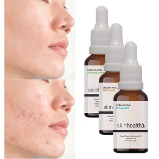 Kit Com 3 Sérum Facial Skinhealth - Renovador Uniformizador Reparador