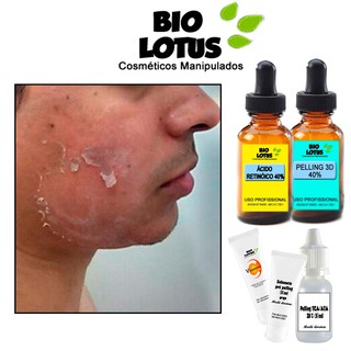kit pelling 3d 10 ml+ acido retinoico 40% 10 ml+ vit c