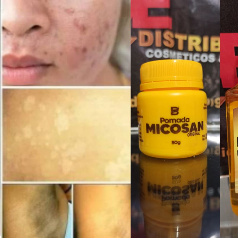 Pomada Clareadora Micosan original axilas, virilhas, melasma etc. 1 Unidade 50g Original