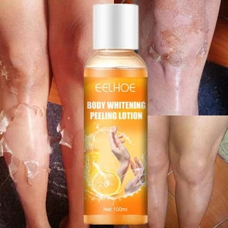 Gel Branqueador Imediato Descascador De Pele Máscara Fnger Joelho Axilas Manchas Escuras Creme Brilhante Corporal Limpo