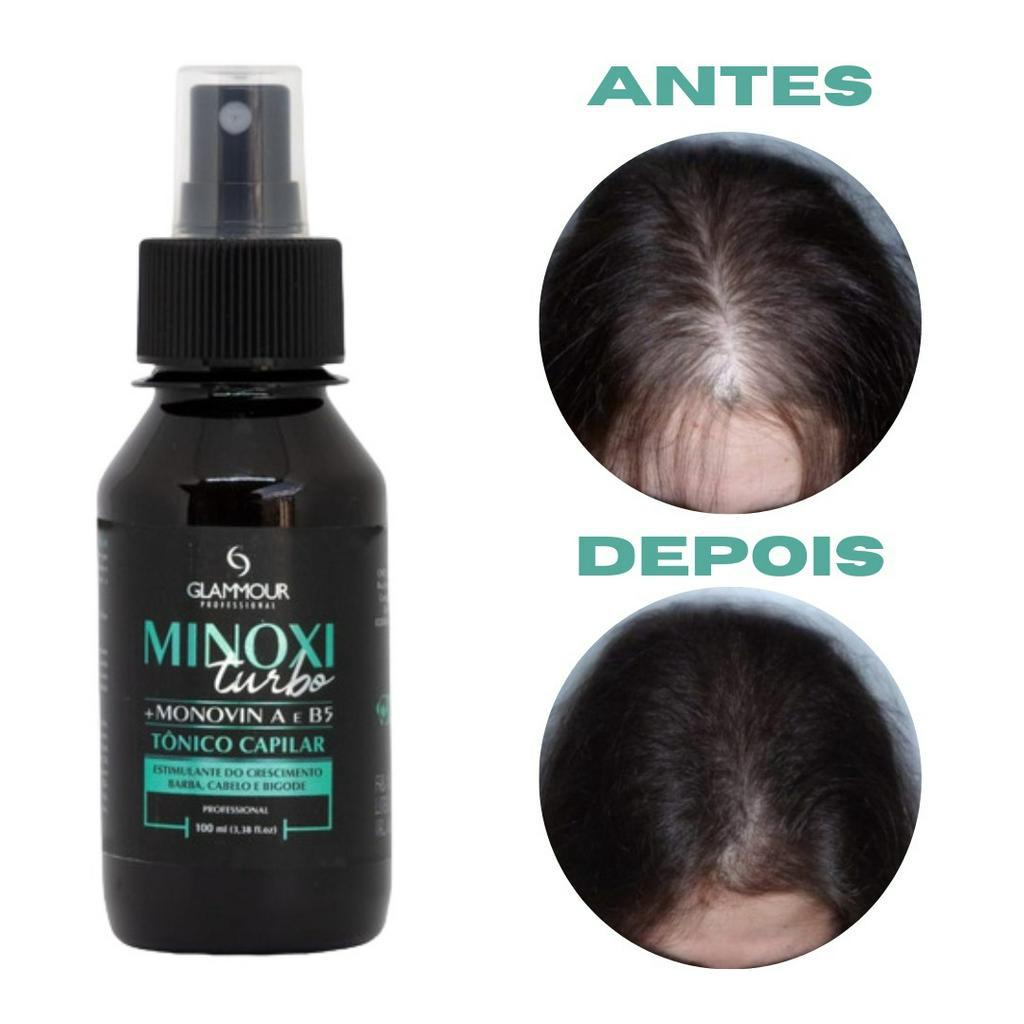 Tonico MINOXI TURBO Antiqueda Fortalecedor Capilar Cabelo Forte 100ml