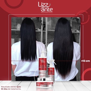 Kit SOS Crescimento Anti queda Preenche Falhas Combate Calvice Trata Alopécia Aumenta o Volume do Cabelo Combate Caspa e Oleosidade Hidrata Brilho Intenso Tratamento Capilar Lizz ante
