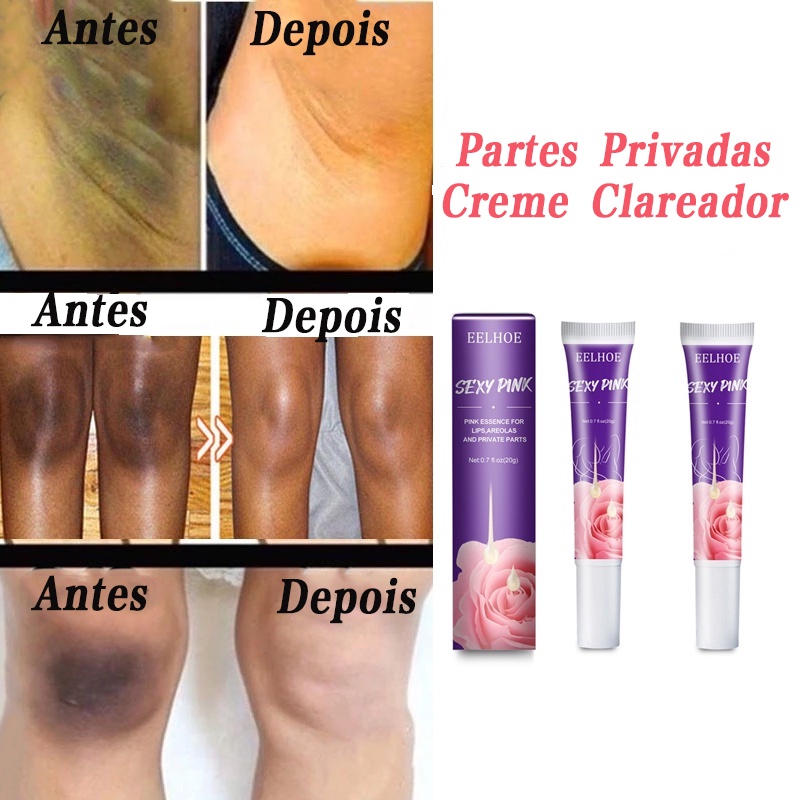 Miss V Creme Clareador Para Clareamento De Coxa/Refrigeramento/Do Corpo ...