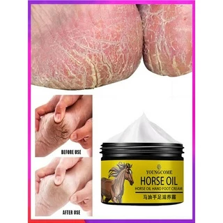 5G/15G/30G/50G/Foot Creme Para Reparo De Rachaduras No Calcanhar Remover A Pele Morta Mão E O Branqueador Da Dos Pés