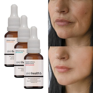 Kit Antienvelhecimento Trata E Previne Rugas 3 Séruns Sh