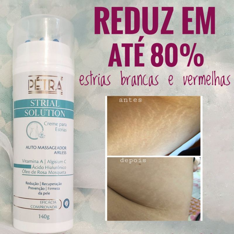 STRIAL SOLUTION - CREME PARA ESTRIAS 140g | Shopee Brasil