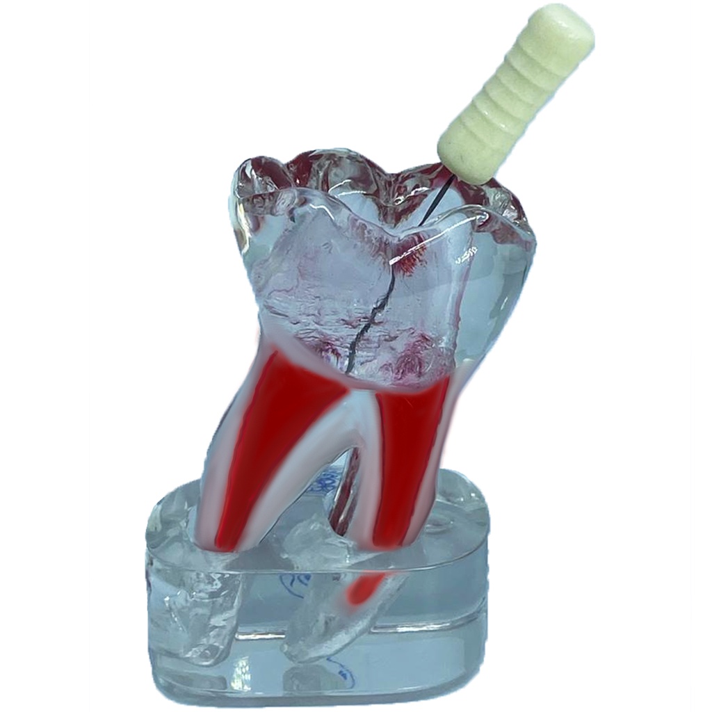 Macro Modelo Endodontia de Molar
