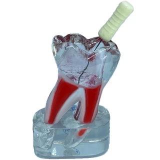 Macro Modelo Endodontia de Molar