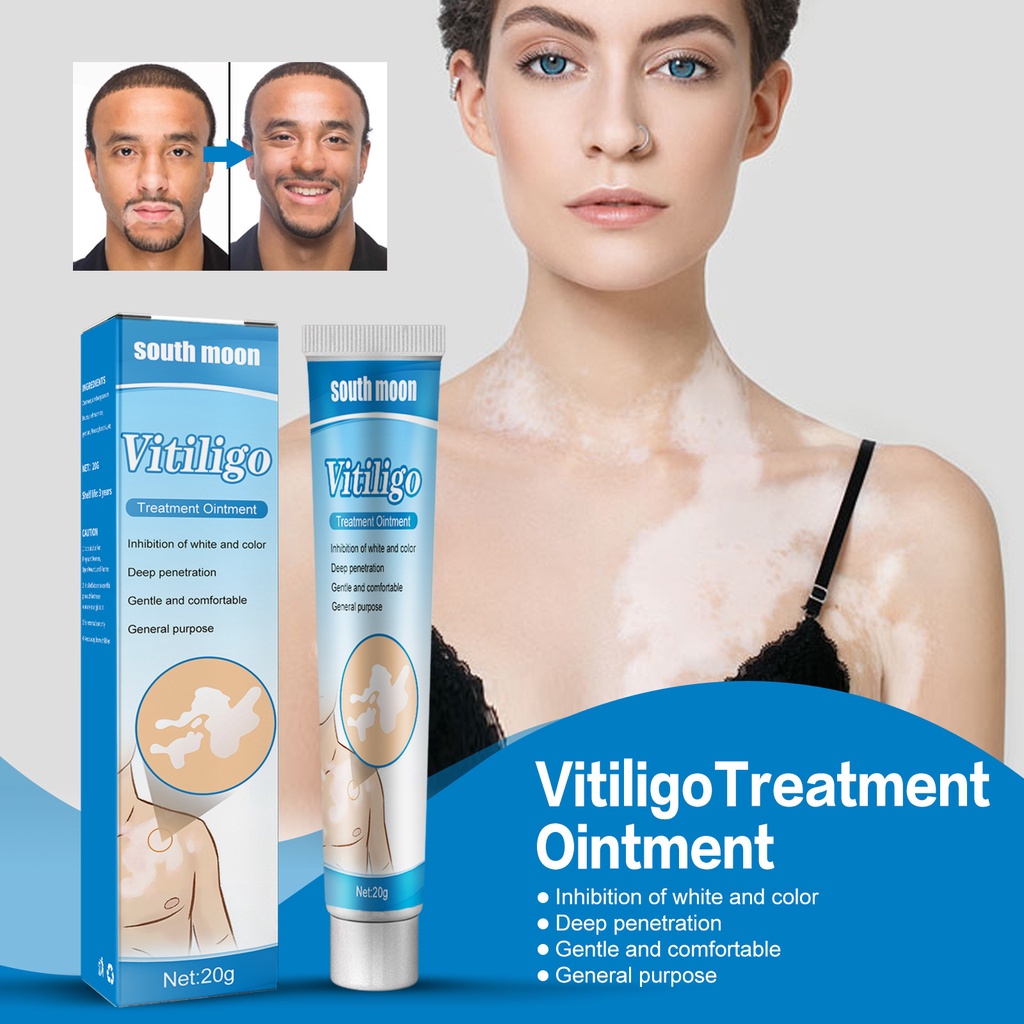 20g Creme De Tratamento Vitiligo Remove Manchas Brancas Ringworm