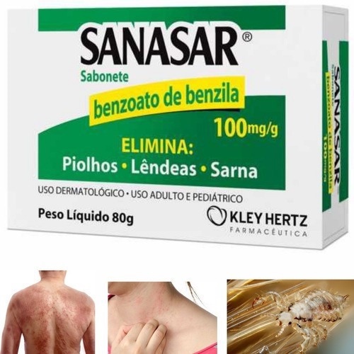 Sanasar Benzoato Benzila Sabonete 80g (Elimina Piolhos Lêndeas Sarna)