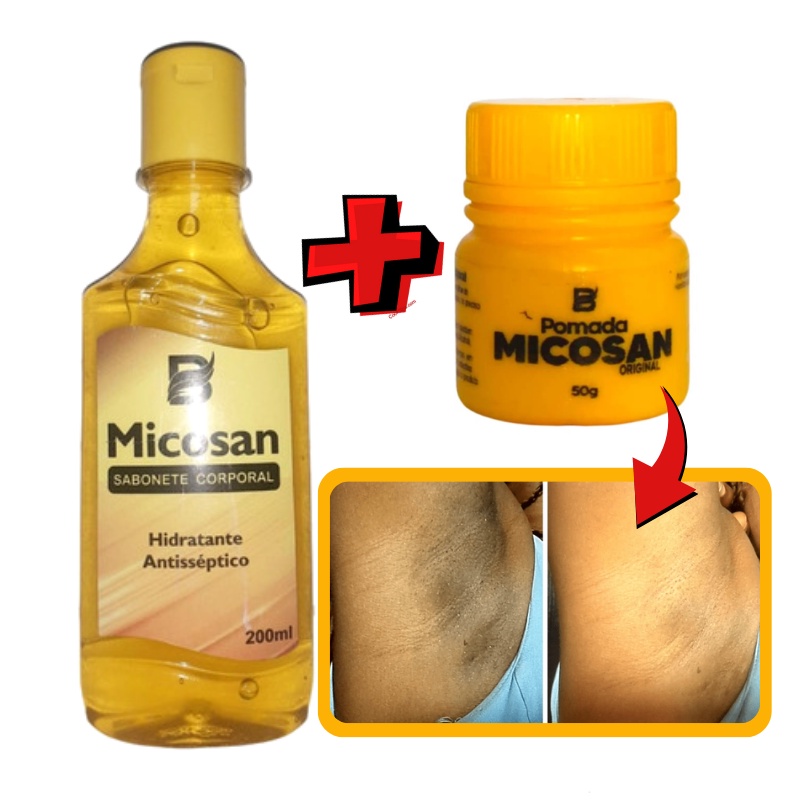 Kit (Com 2 Itens) - Pomada + Sabonete LÍQUIDO Micosan Original Clareador de Manchas - Promoção Imperdível