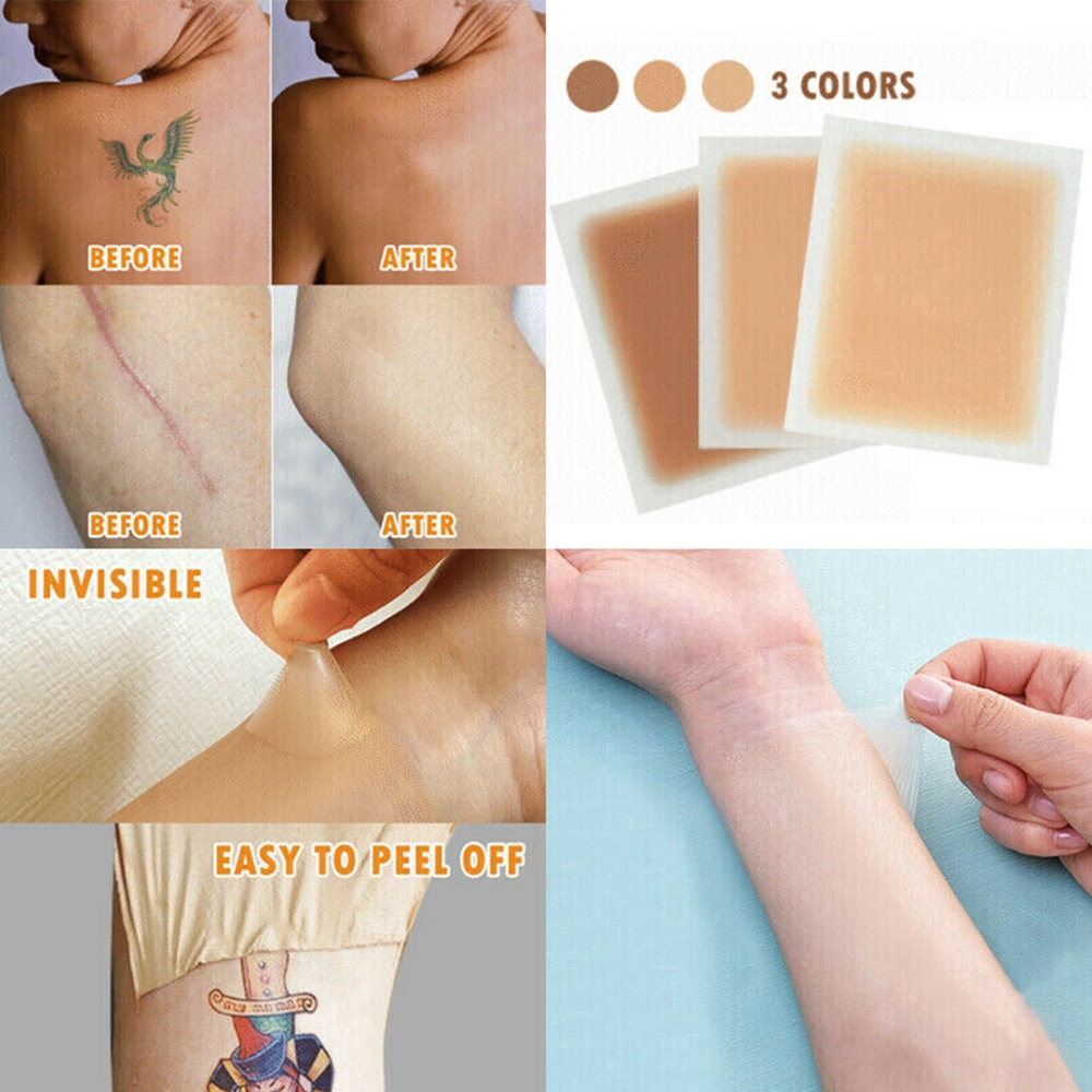 Fita Invisível para Esconder Tatuagem/Cicatriz/Falha/Acne Ultra Fina ...