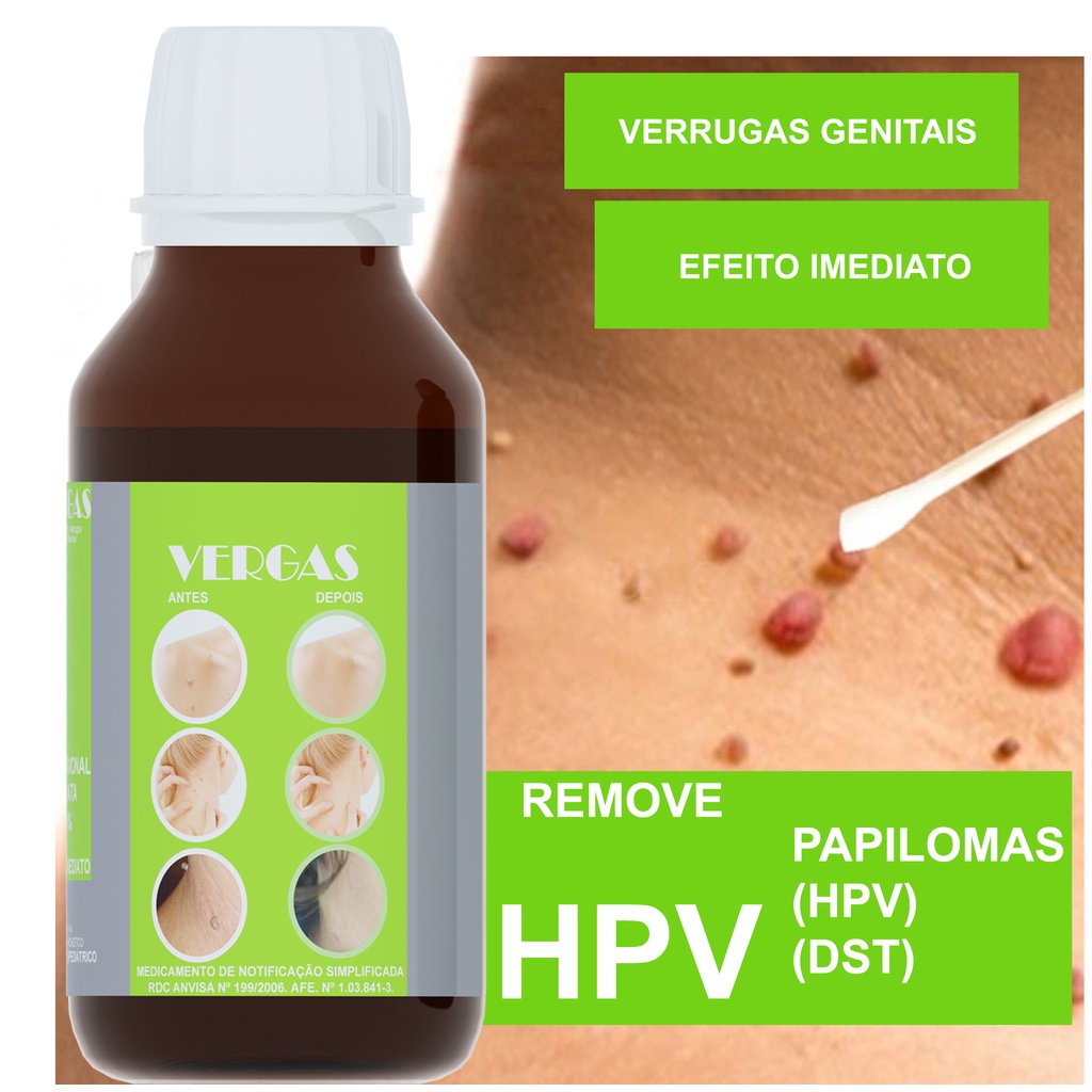 Acido Tricloroacético 90% Tca Ata - Hpv Eliminar Verrugas