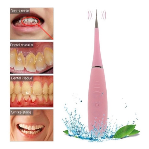 Removedor De Tártaro Cálculo Dental Elétrico Raspador Usb