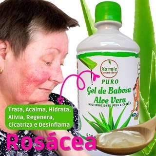 Gel Babosa Hidrata e Desinflama Rosácea 500ml - 100% Natural e Orgânico