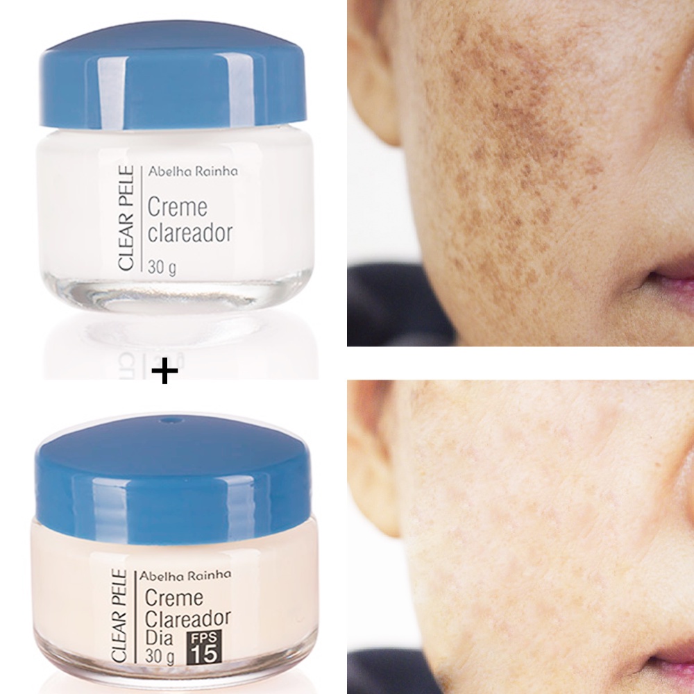Kit 2 Clear Pele - Creme Clareador de Manchas Faciais Dia + Noite ...