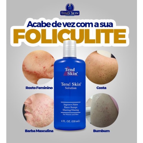Tend Skin Solution 118ml - Loção para Foliculite e Pelos Encravados