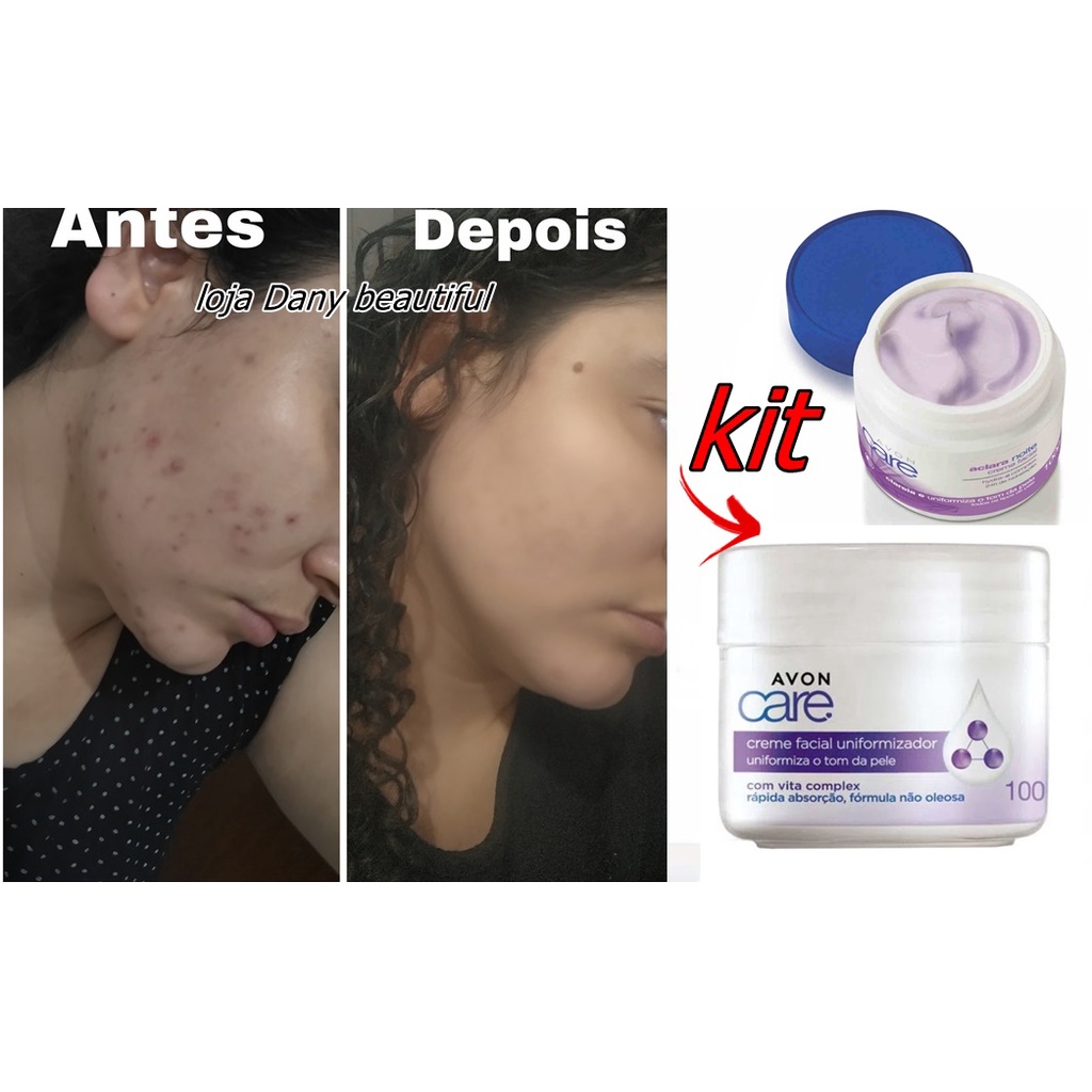 Creme Hidratante Facial Clareador Aclara Care- avon Dia e noite