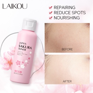 LAIKOU Sakura Toner Hidratante Facial Reduzir Manchas Escuras Claregar 100ml