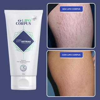 Lipo Corpus Creme para Remover Estrias | ENVIO RÁPIDO