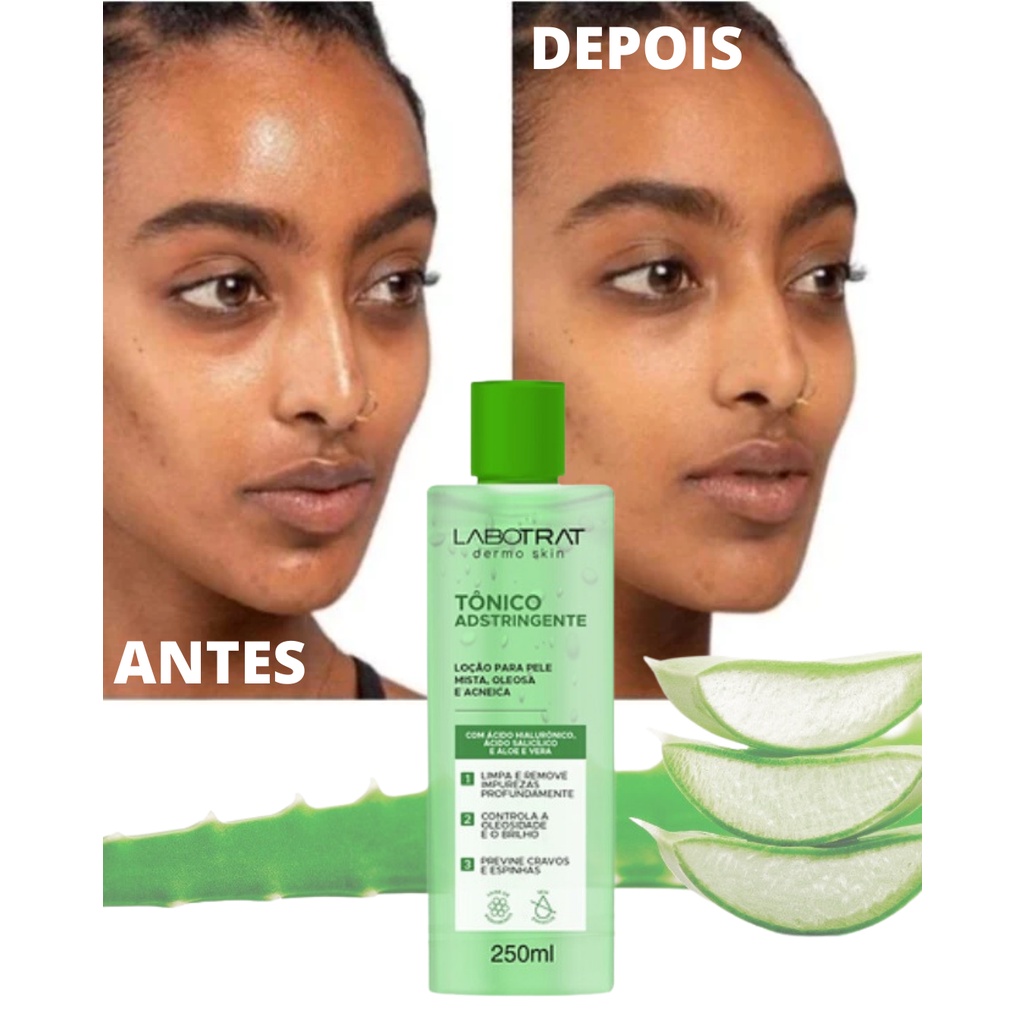 Tônico Adstringente para Pele Oleosa Labotrat | Shopee Brasil