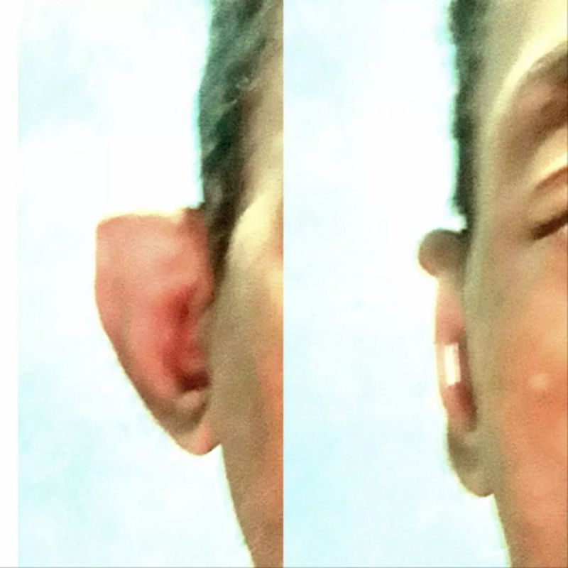 Piercing para orelha de abano