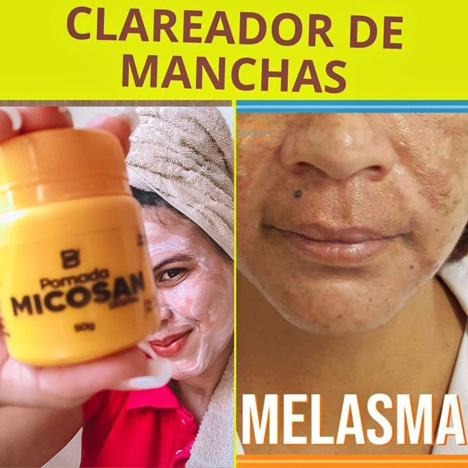 Creme Tira Manchas Escuras Da Pele | Shopee Brasil