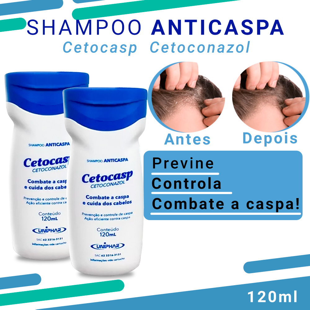Tratamento de Caspa Anticaspa Cetocasp Shampoo Cetoconazol - Uniphar ...