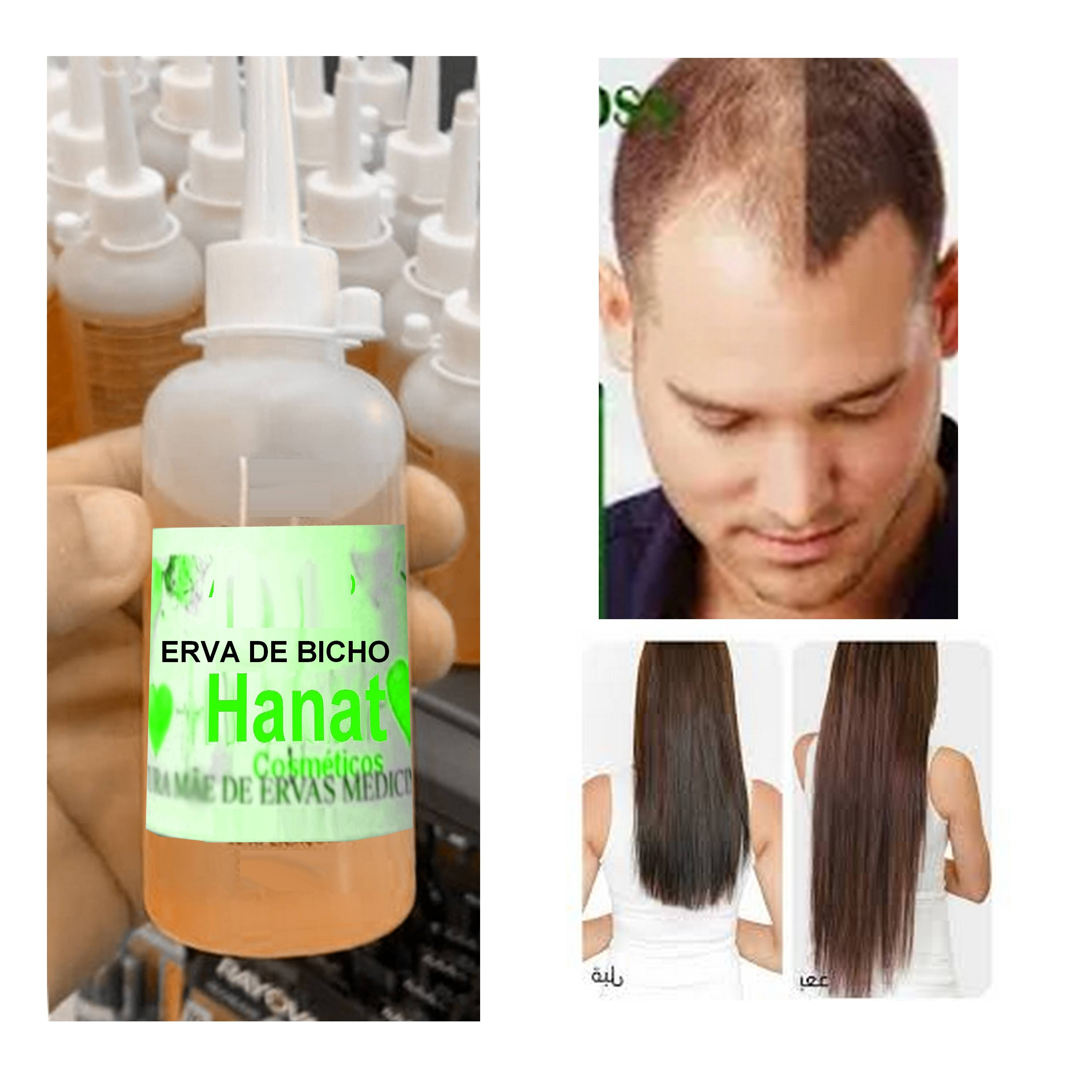 erva de bicho anti queda - tonico capilar natural feito da erva para ...