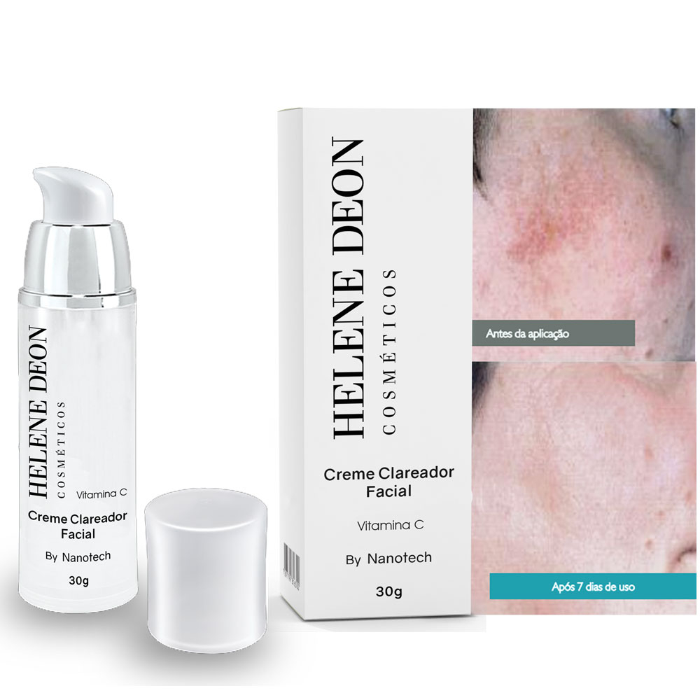 Creme Para Tirar Manchas De Melasma Do Rosto e clareador com ...