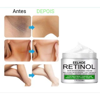 Creme Clareador Retinol Clareamento/Corporal Clareadora/Axilas/Pernas/Virilha Retinol 50ml