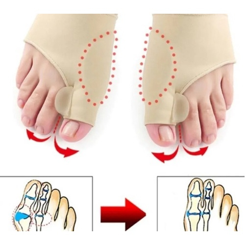 Par De Meias Correção Corretor Corretivo Ortopédico Joanete