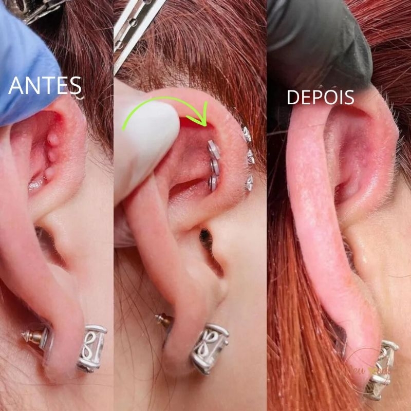 Piercing De Septo Em Aço Inoxidável No Anel Da Boca, Goth C Rod