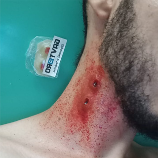 Sangue Falso Para Maquiagem de Vampiro e Machucados com Dentadura, Ferida