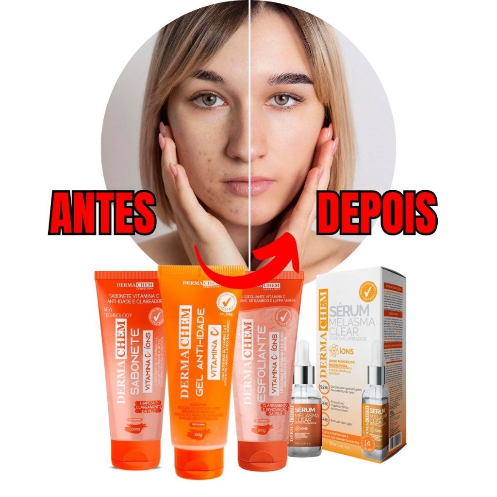 Kit Skin Care Clareador Facial Melasma Vitamina C peles com Manchas Dermachem 4 produtos Sérum, Sabonete, Gel Hidratante e Esfoliante