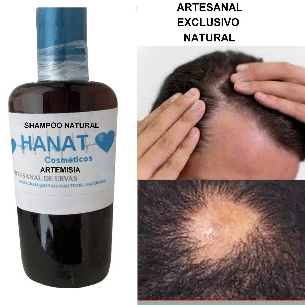 Shampoo de artemisia para tratar couro cabeludo danificado ou afetado ...