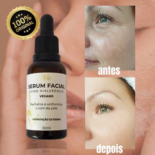 Sérum Facial Vegano Hidratante Anti-rugas e Clareador de Manchas com Ácido Hialurônico + Óleo Rícino + Aloe Vera + Erva Doce