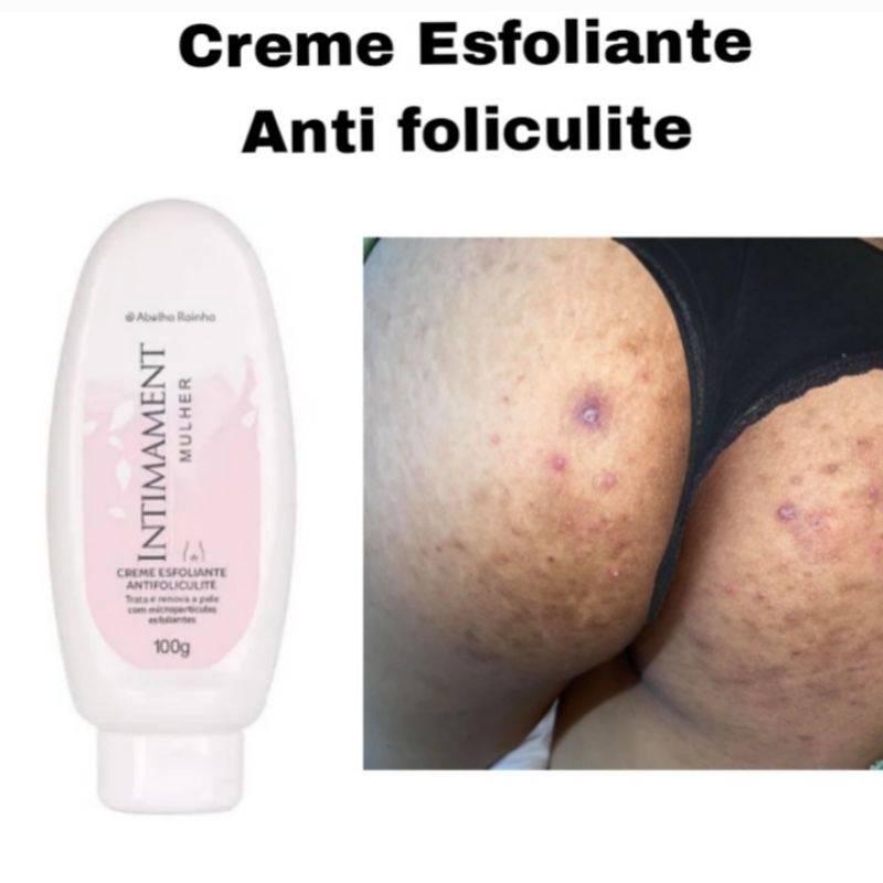 esfoliante foliculite corporal abelha rainha. | Shopee Brasil