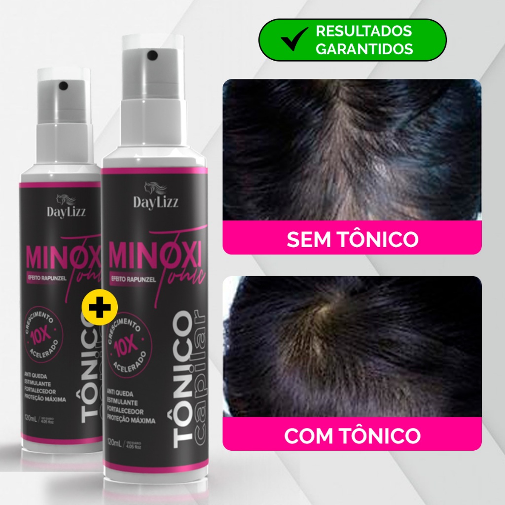Kit Tônico Capilar Super Poderoso melhor que Minoxidil - 2 Unidades