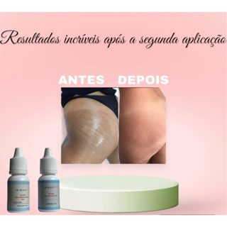 KIT CLAREADOR DE ESTRIAS 10 ml ENVIO IMEDIATO