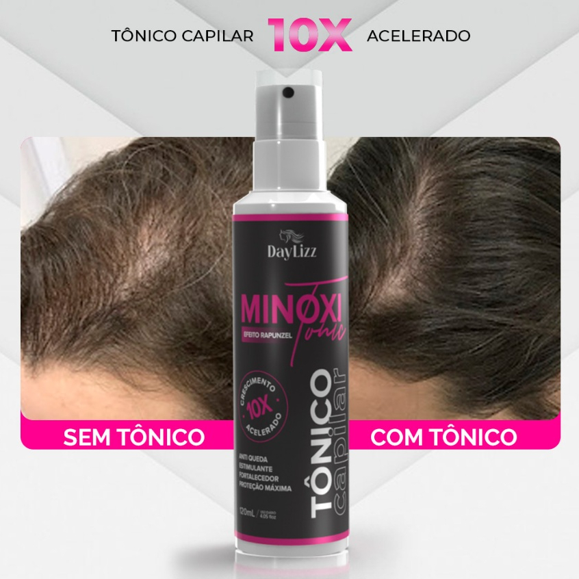 Tônico de Crescimento Capilar Super Poderoso - Minox Tonic