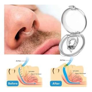 Clip Nasal Anti Ronco Magnético Com Imã Apneia Nariz