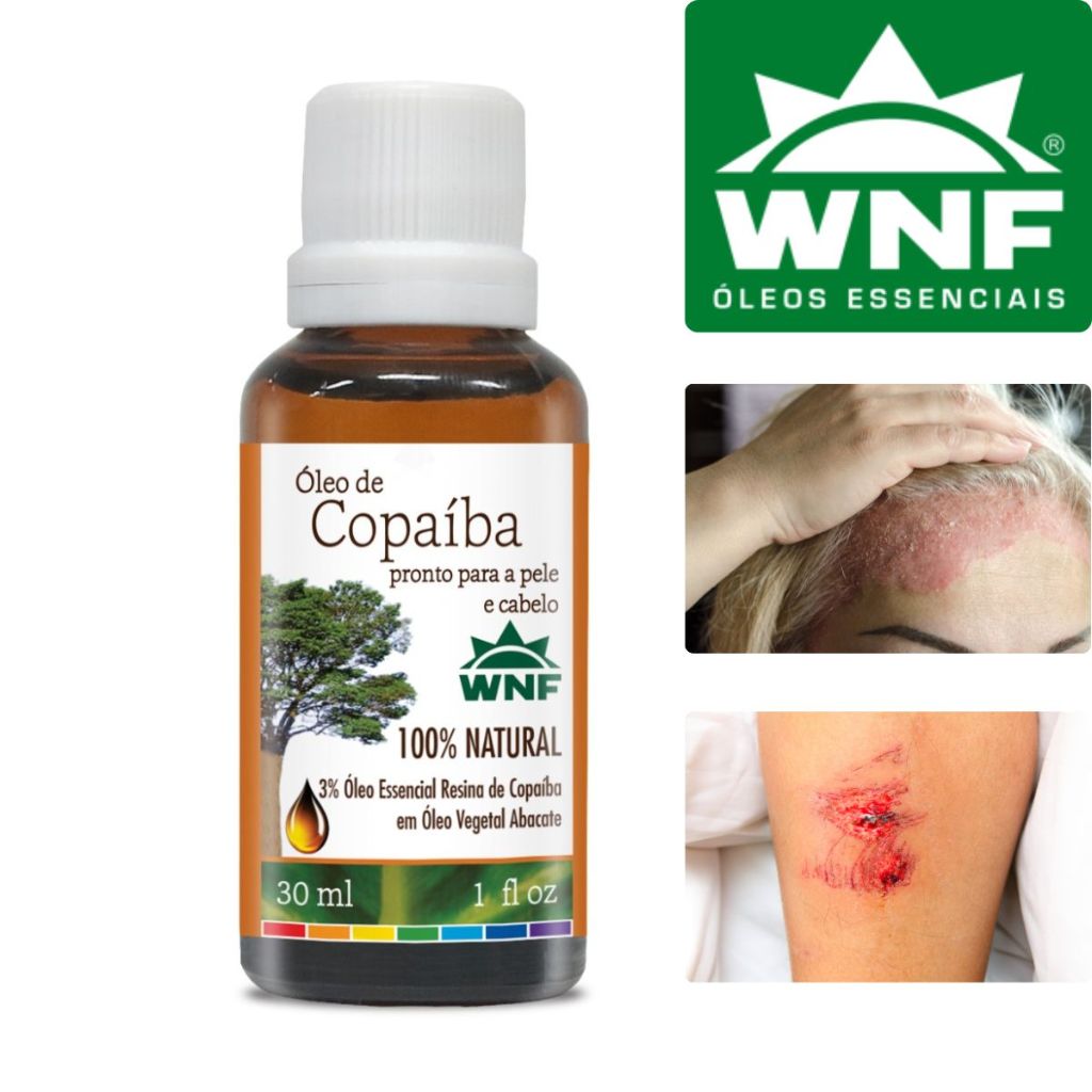 Óleo de Copaíba Pronto para Pele e Cabelo WNF 30ml | Shopee Brasil