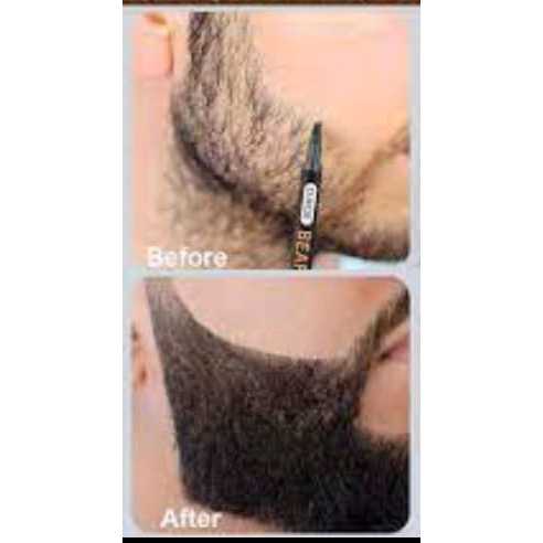 Lápis Caneta de Pigmentação é a Solução para Falhas na Barba