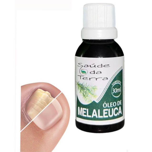 Óleo de melaleuca elimina fungos e bactérias Seca Espinha | Shopee Brasil