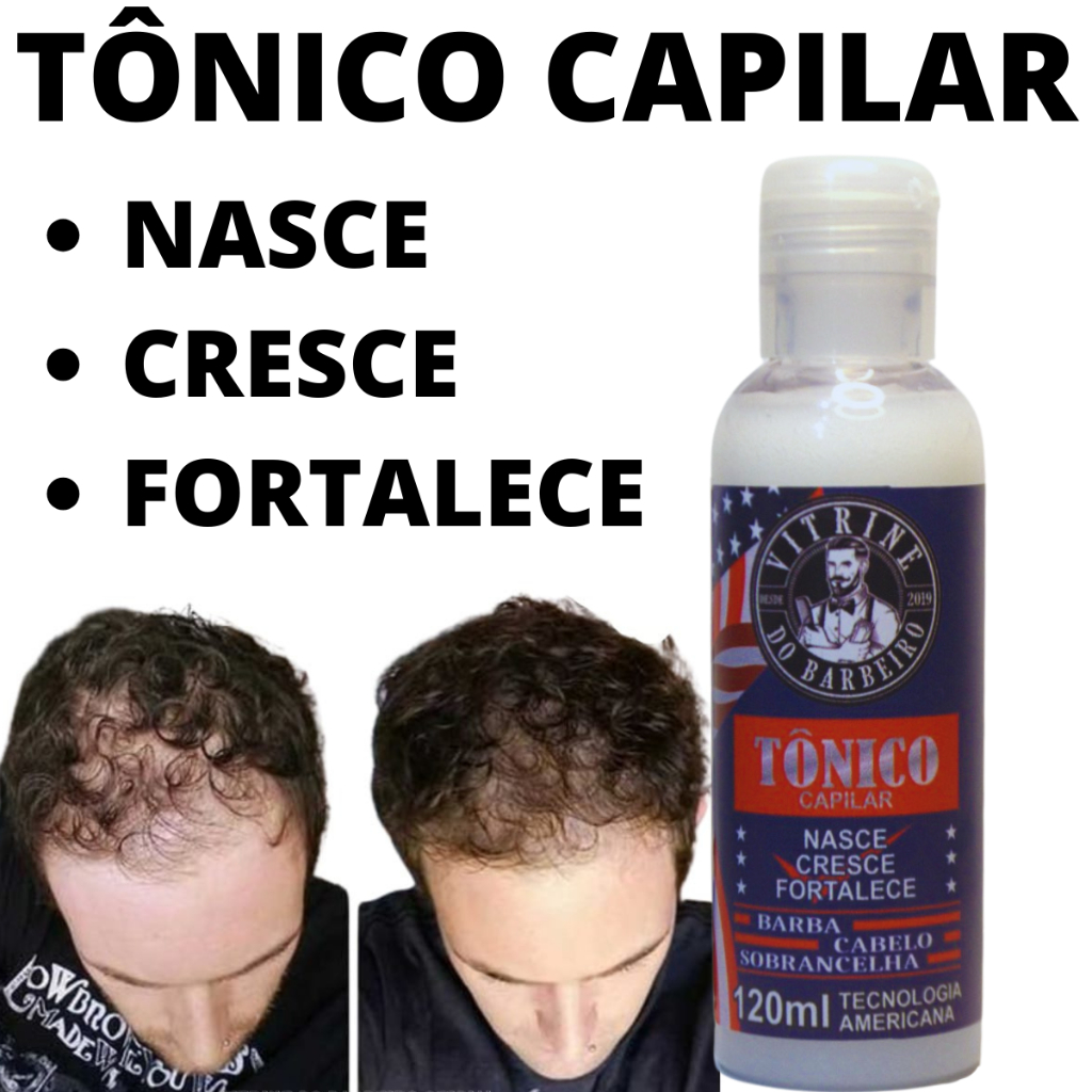 O Melhor Tônico Capilar Para Crescimento e Fortalecimento | Shopee Brasil
